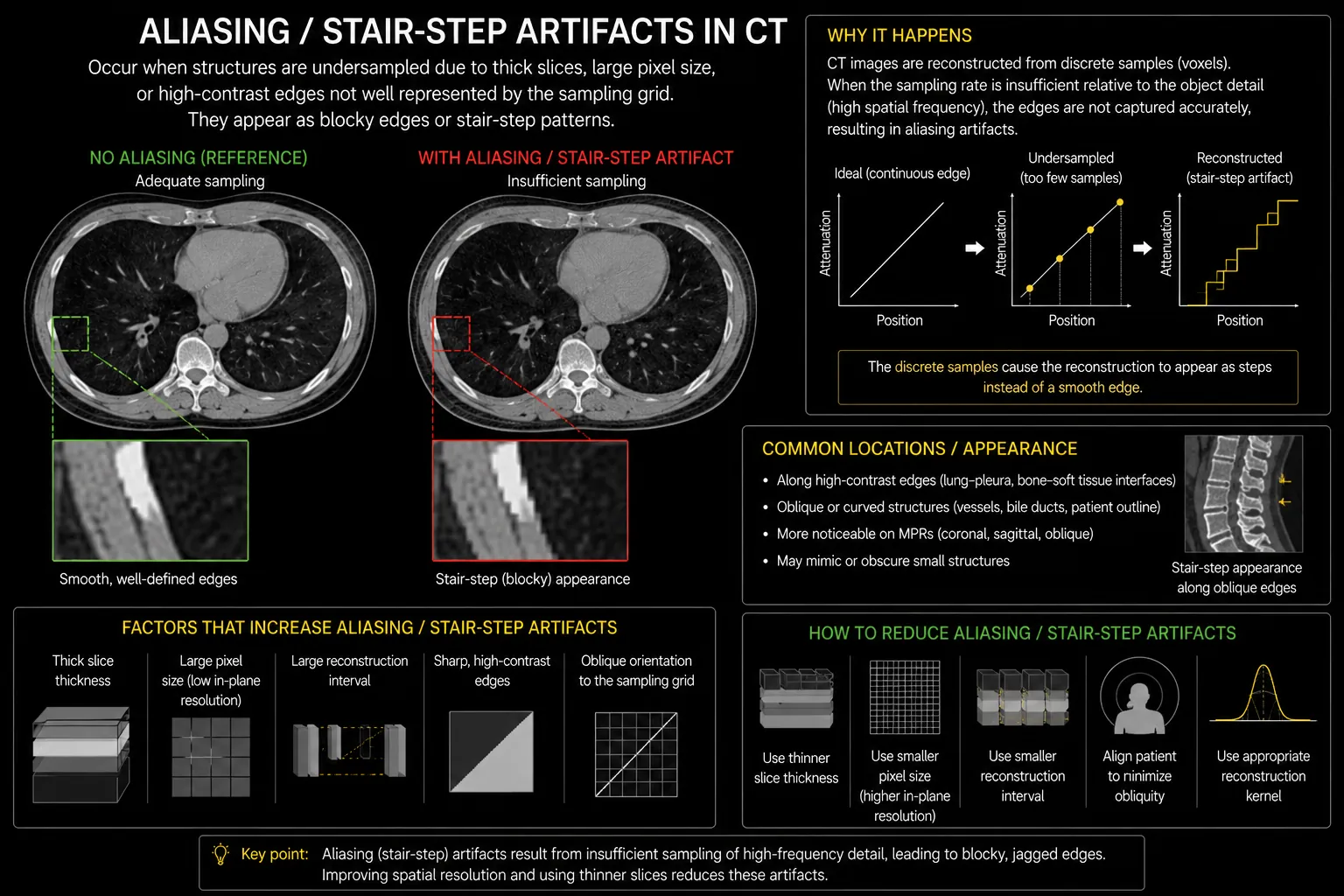 Aliasing and stair-step CT artifact infographic