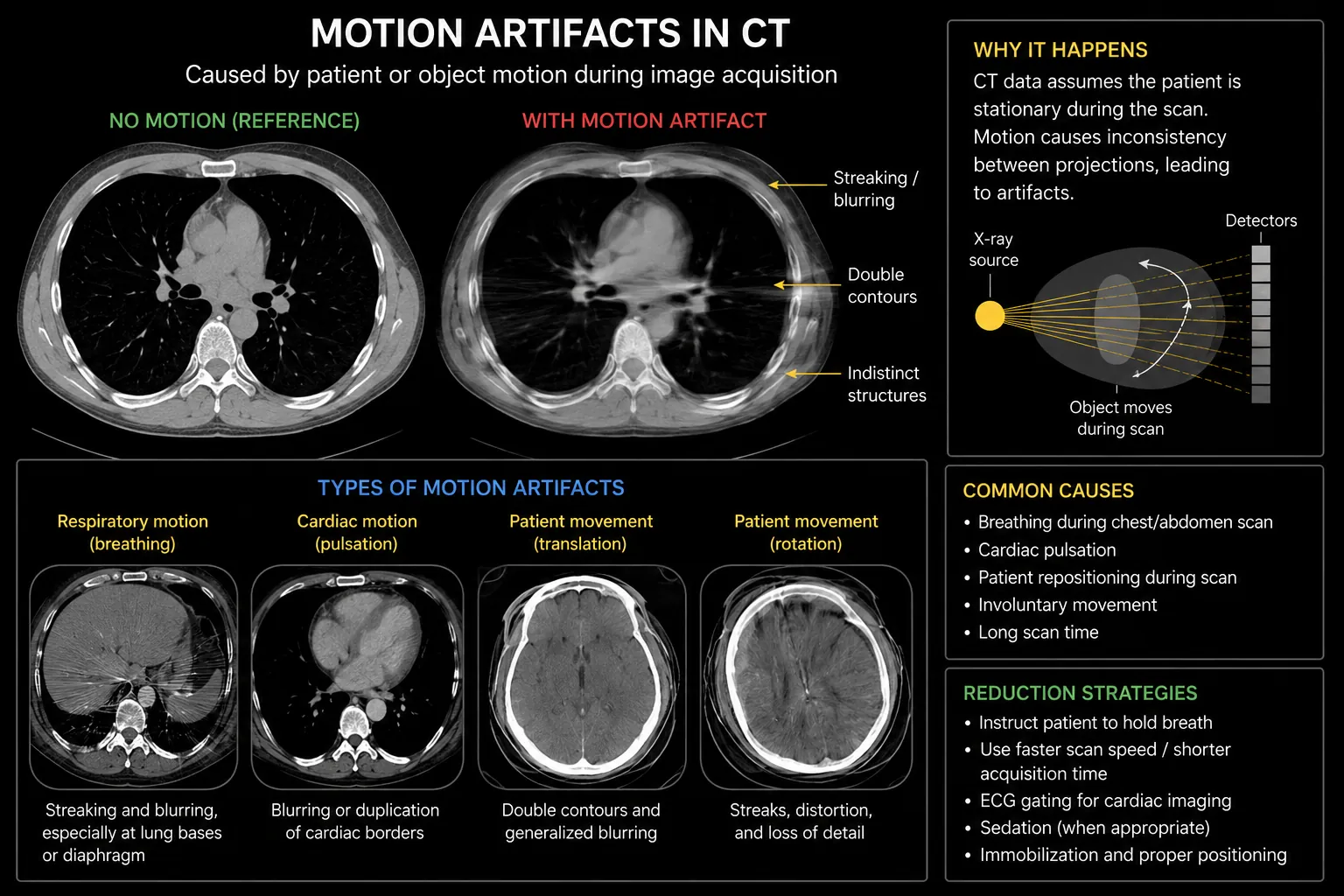 Motion CT artifact infographic