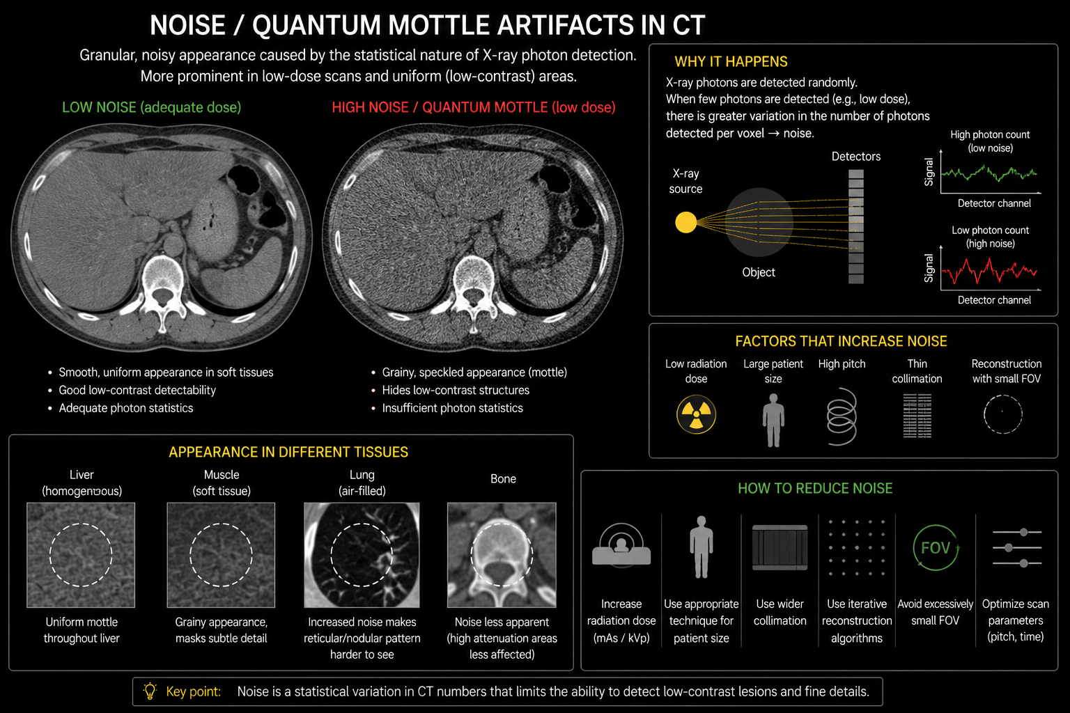 Noise and quantum mottle CT artifact infographic