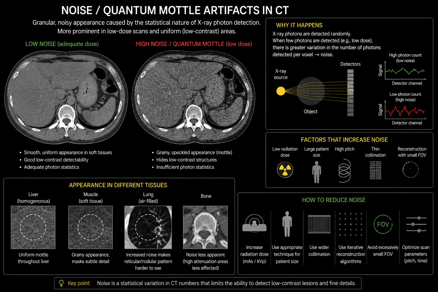 Noise and quantum mottle CT artifact infographic