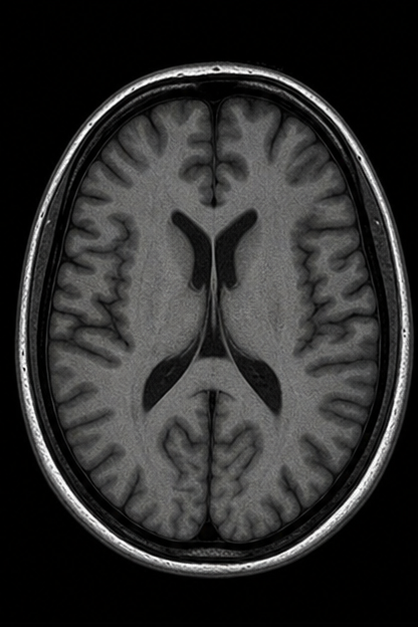 Generated axial T1-weighted brain MRI scan for pulse sequence learning