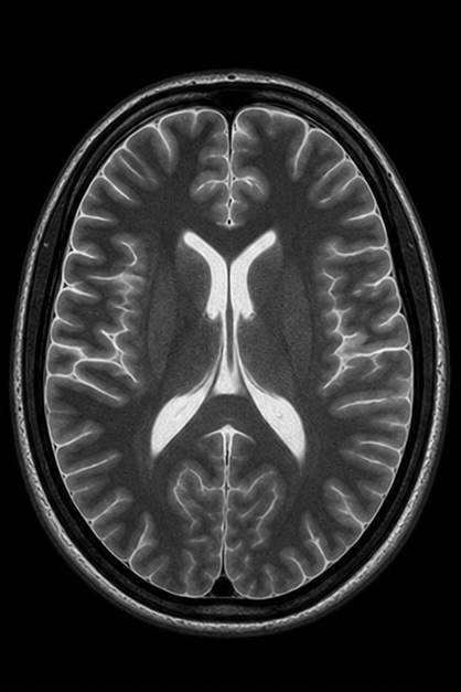 Axial brain MRI image forming from detected resonance signal