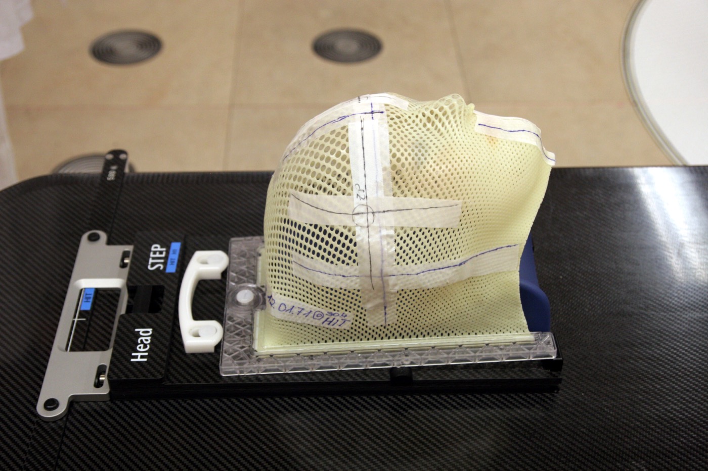 Thermoplastic immobilization mask used to reproduce head and neck positioning during radiotherapy.